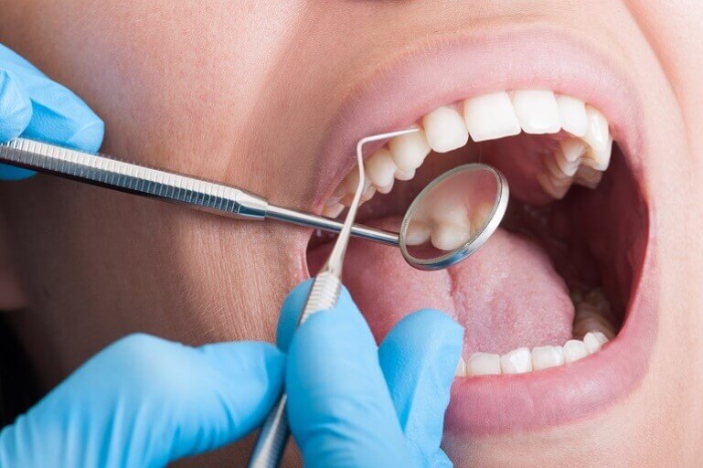 Dentista realizando análise em profilaxia bucal em paciente.