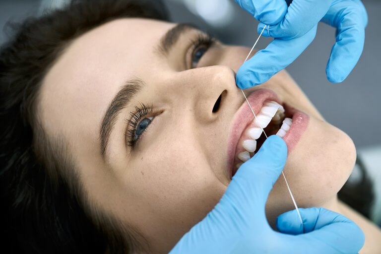 Dentista passa fio dental em profilaxia bucal no paciente.